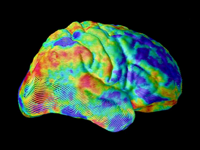 Image of brainscan taken from internet